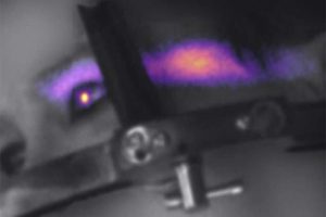 科学家在癌症病人眼球内拍到诡异蓝光，原是超光速光爆现象