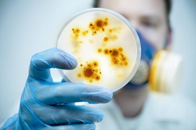 为什么实验室还保存着高度传染性病毒？