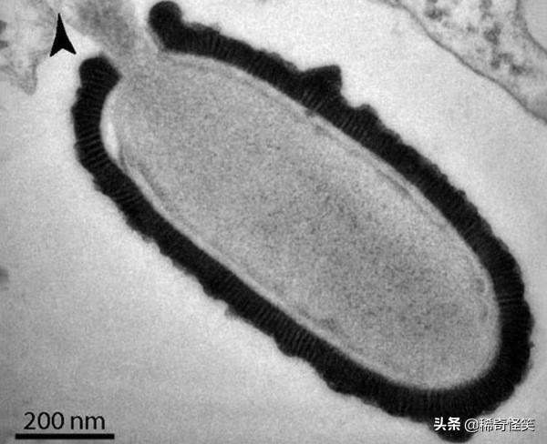 疯狂科学家给自己注射350万年前的细菌，结果怎样了？