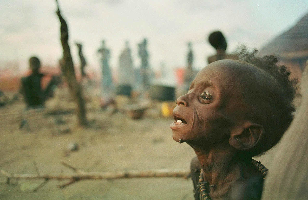 饥饿的非洲小孩图片图片